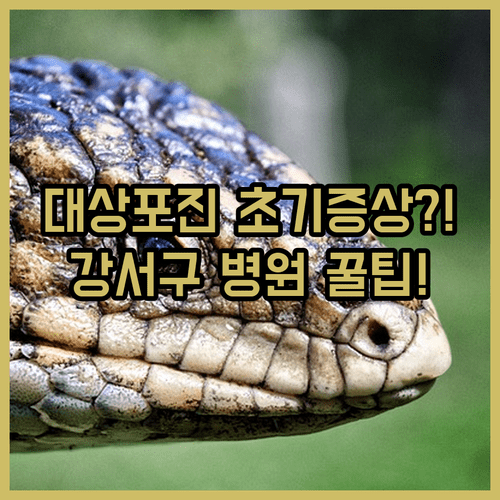 image bd362bd7